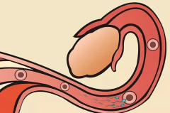 <b>输卵管通了还不怀孕？这都有哪些原因引起呀？</b>