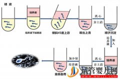 国外hiv做试管婴儿会不会保密？