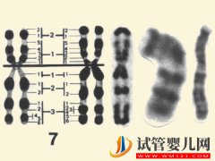 7号染色体异常真不是骗局，出现三体、偏多孩子