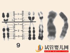 9号染色体决定什么：出现嵌合、三体等异常后果