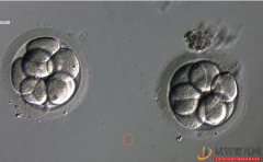 2pn胚胎是不是优质胚胎？移植成功率说明了一切