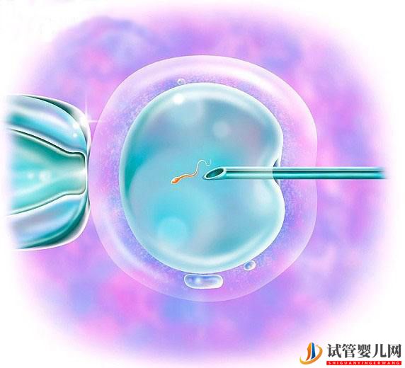 第三代试管婴可以排除染色体异常吗(图1)